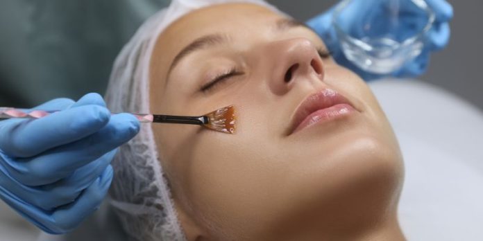Chemical Peel Treatments Chemical Peel Treatments